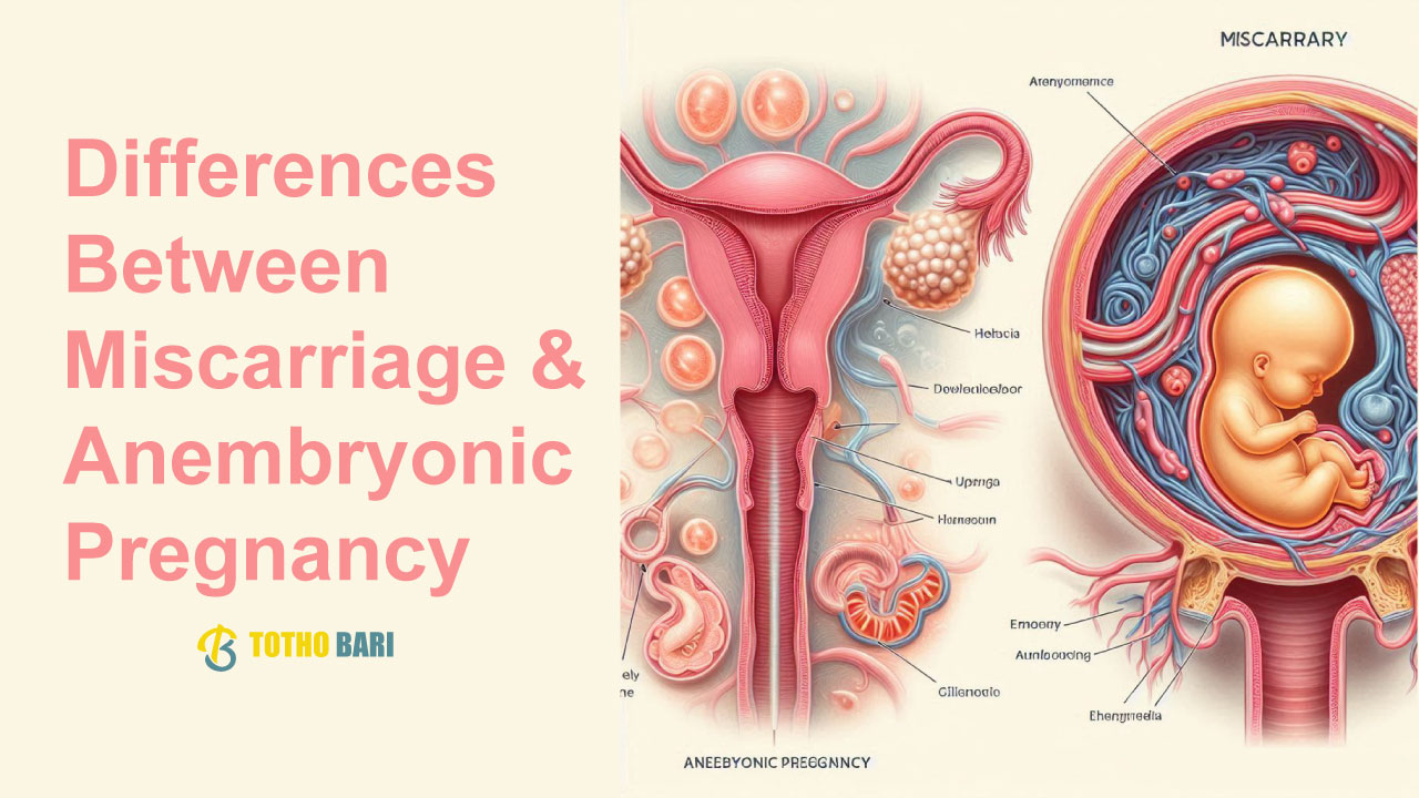 Differences Between Miscarriage Anembryonic Pregnancy